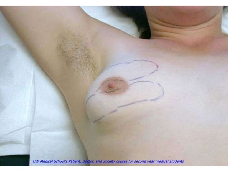 medical breast examination Milf garter tube